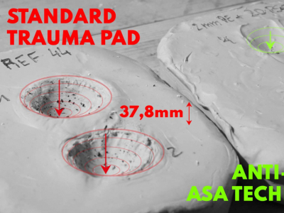 Understanding Behind Armor Blunt Trauma (BABT)